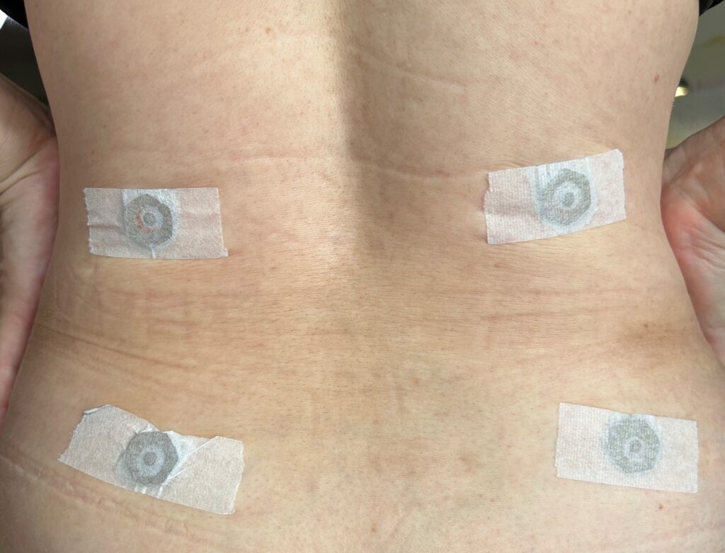 腰椎椎間板ヘルニア、4個で、四角の場を作ることで、痛みが和らぎます